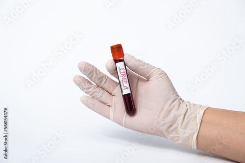 Blood collection tubes Group A Streptococcus test. strep A epidemic. photo