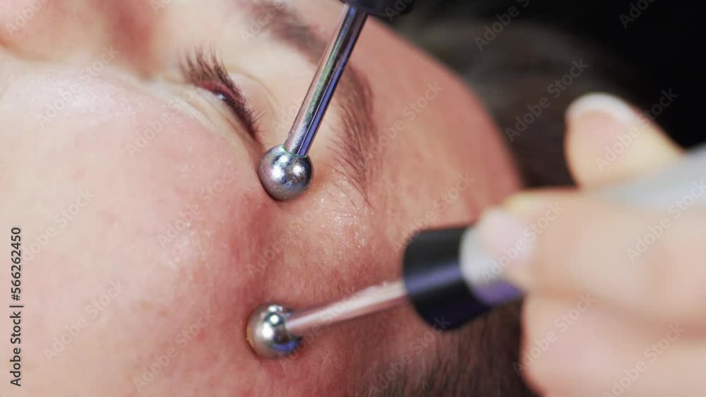 Microcurrent Lip close-up microcurrent procedure treatment of chin lines microcurrent ...
