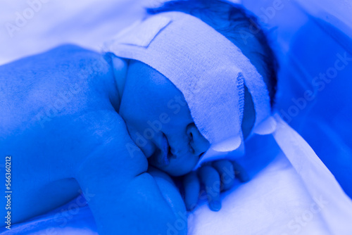 A newborn baby lies under ultraviolet lamps, under blue light. High bilirubin, treatment of childhood jaundice, ultraviolet incubator. photo