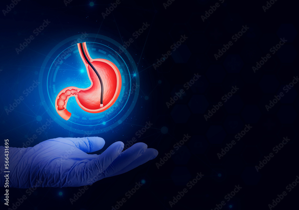 Endoscopic biopsy, esophagogastroduodenoscopy, EGD. Human stomach isolated on technological