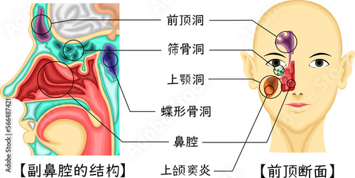 副鼻腔 構造 イラスト