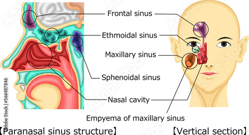 副鼻腔 構造 イラスト