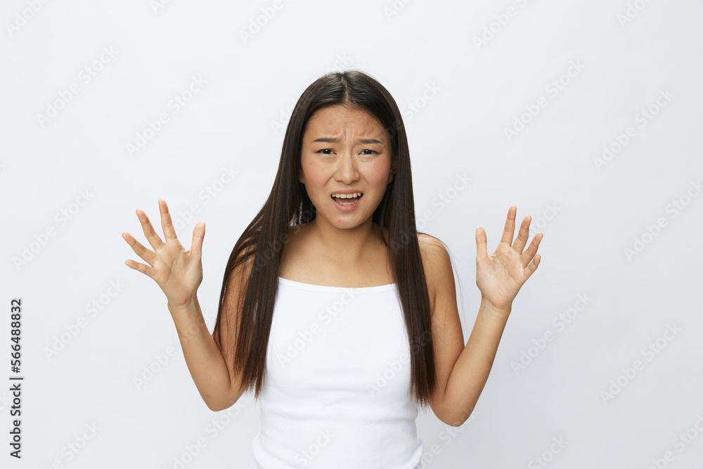 Asian woman facial skin problems, acne and inflammation, red rashes and allergies, chicken pox, sadness from rashes. Facial skin care concept for diseases and nerves Asian woman facial skin problems, acne and inflammation, red rashes and allergies, chicken pox, sadness from rashes. Facial skin care concept for diseases and nerves