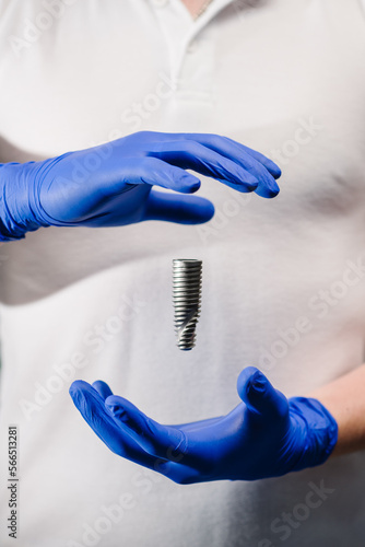 Dental implant. Dentist hold a model of dental implant in hand. Concept of implantation teeth and dental surgery. Space for text. Hand in glove showing the installation of a dental implant. Closeup.