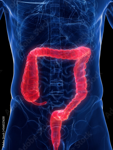 3D rendered medical illustration of a man's large intestine