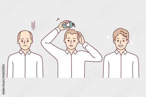 Man using hair growth gel rejoices after seeing good result of cosmetic product. Sad guy uses cream to get rid of baldness on head and get desired bouffant hairstyle. Flat vector illustration