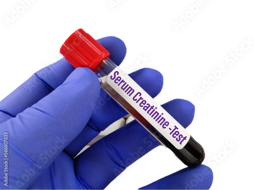Blood sample for Serum Creatinine and Urea test. Copy space on colour background photo
