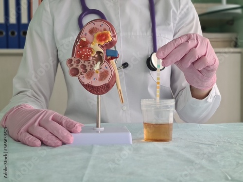 Urologist doctor makes express analysis of urine using indicator paper closeup photo