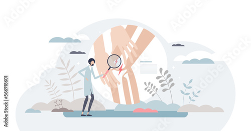 Knee pain with leg bone joint injury or inflammation tiny person concept, transparent background. Physical trauma examination and health problem that hurts and needs doctor diagnosis, therapy.