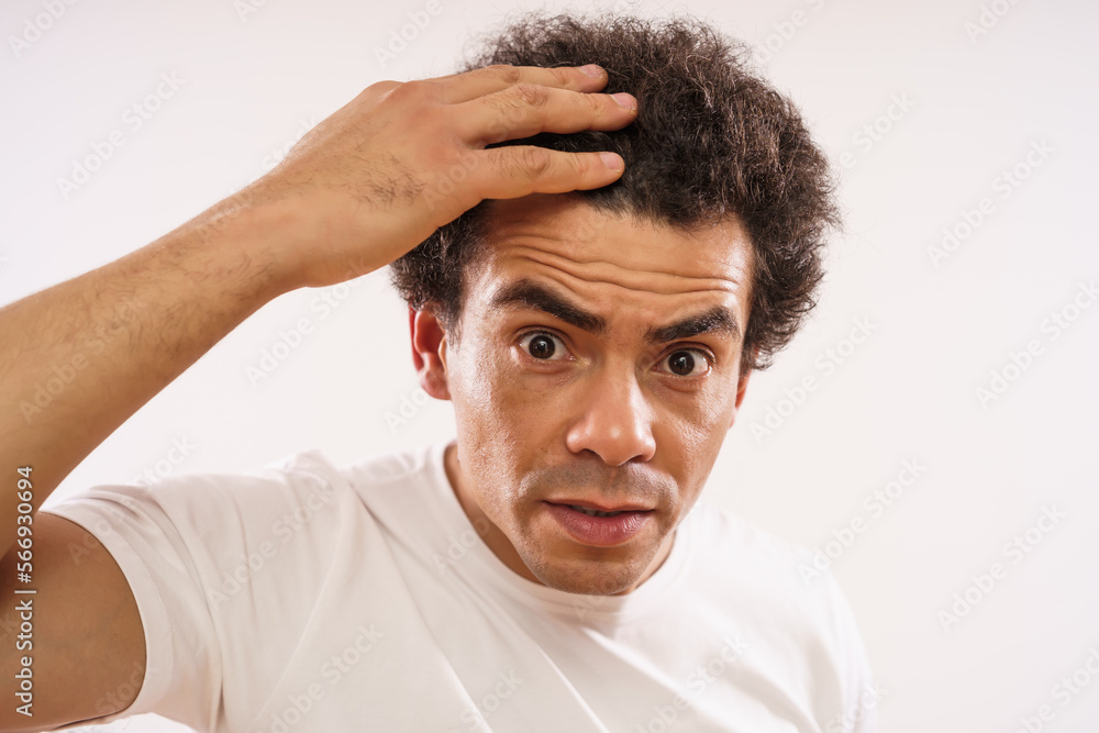 Obraz premium Handsome mixed race adult man is worried because of hair loss.