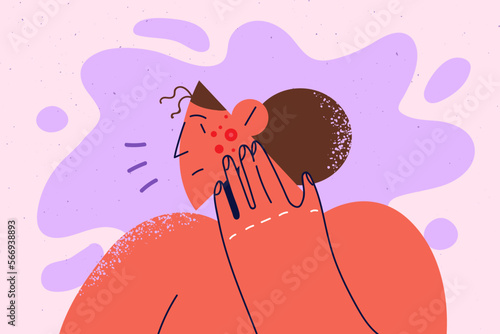 Unhappy woman distressed with pimples on face 
