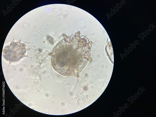 Fotografia Notoedres cati under the microscope
