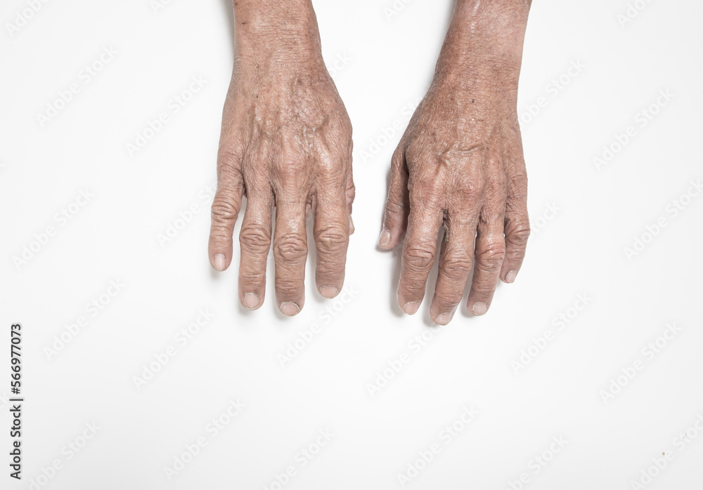 Fototapeta premium Hand and finger expressions seniors with weakness problems and pain in the muscles and bone marrow on a white background