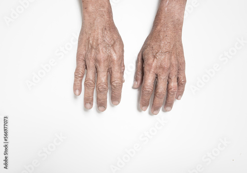 Hand and finger expressions seniors with weakness problems and pain in the muscles and bone marrow on a white background