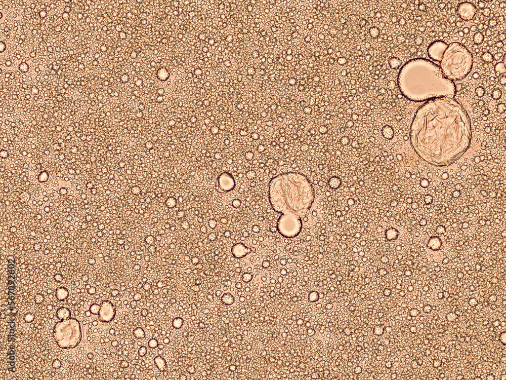 Foto de breast milk under the microscope optical microscope x200 magnification do Stock