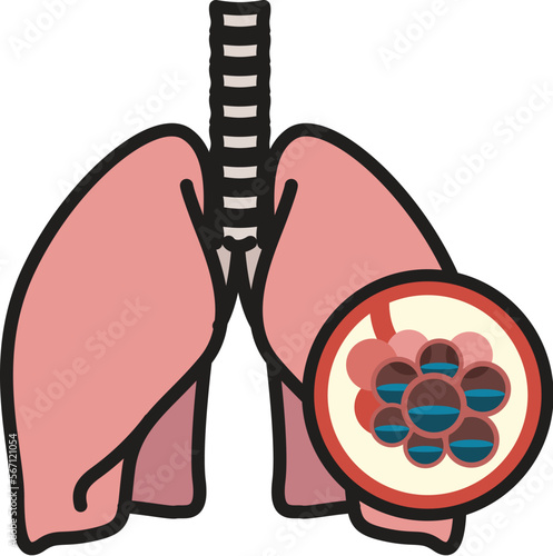 Human Lungs - PULMONARY EDEMA - Illustration