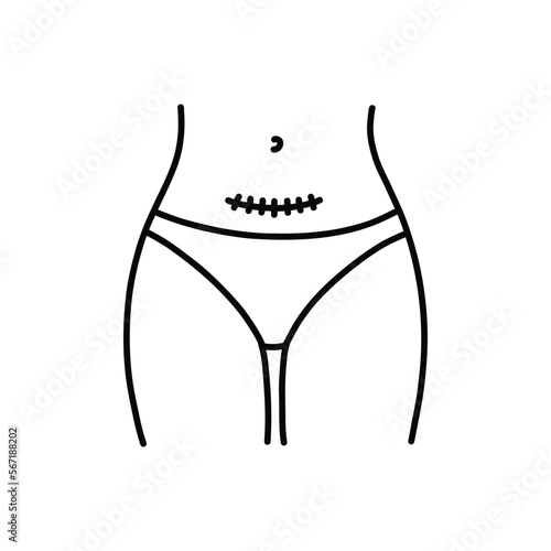 Caesarean section doodle icon, vector color line illustration