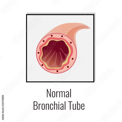 Normal Bronchial Tube Composition