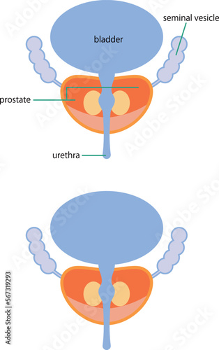 膀胱と前立腺を図解したイラスト／Illustration depicting the bladder and prostate