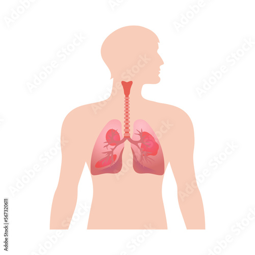 Asthma Affected Lungs Composition