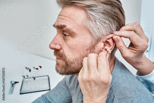 Audiologist inserting ITE hearing aid in adult man's ear at audiology center, close-up, side view. Deafness treatment, hearing solutions photo