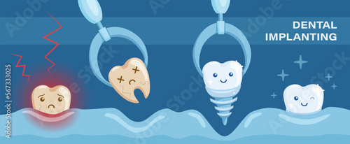 Dental operation poster with showing of removing the ill tooth and replacing it with dental titanium implant. Healthcare poster, banner for dental clinics and surgeries.