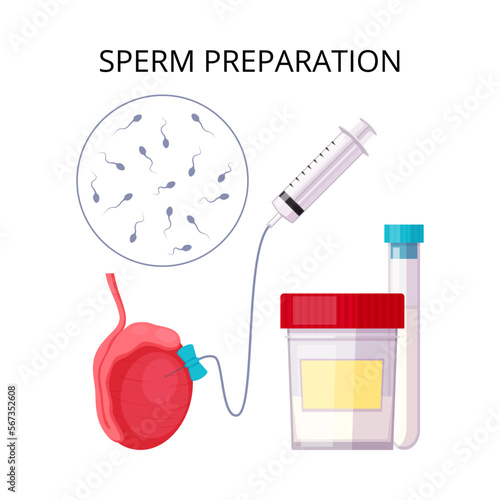 Sperm Preparation Flat Composition