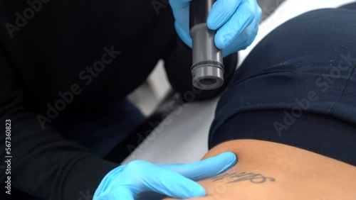 Girl erasing tattoo of exboyfriend name, deleting or removing. Dermatologist clinic tatto erase professionaly. photo