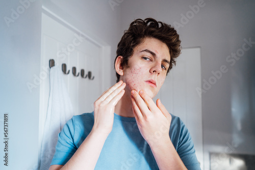Fototapet Concentrated caucasian teenage boy with acne problem at his face looking in mirror at home bathroom