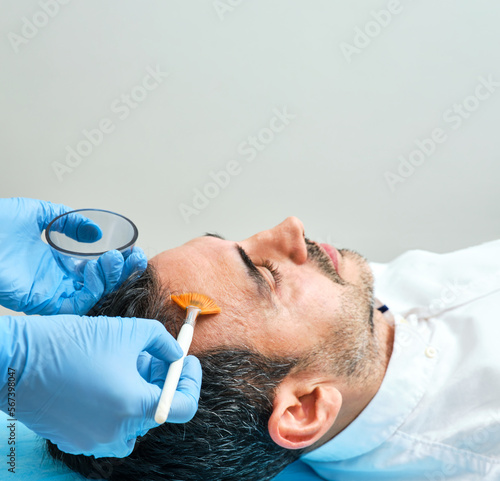 45-year-old dark-haired man in an aesthetic clinic doing a chemical peel