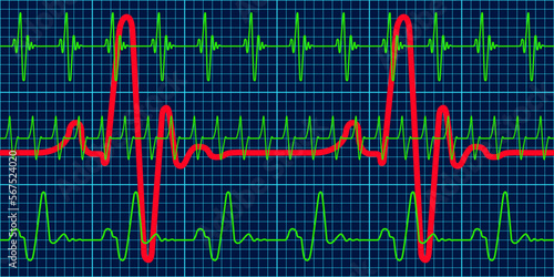 Cardiogram charts pattern