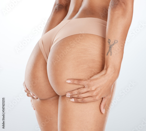 Fotografija Model underwear, hands or lifting butt in bum surgery, cellulite goal or stretch mark solution for body liposuction