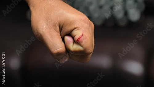 Deep scratches, cut on a man hand skin. Fresh wound, abrasions. Injured hand with blood. Close up