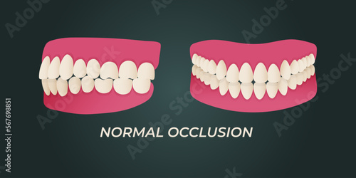 Medical dental diagram illustration. Orthodontist human tooth anatomy. Vector infographics with teeth diagrams.