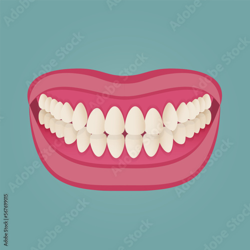 Human teeth malocclusion set with realistic images of mouth jaws with crooked teeth and text captions. Normal and abnormal occlusion. Vector illustration