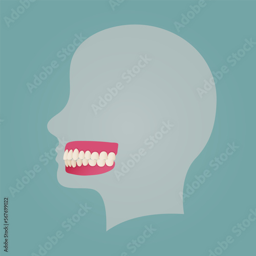 Human teeth malocclusion set with realistic images of mouth jaws with crooked teeth and text captions. Normal and abnormal occlusion. Vector illustration