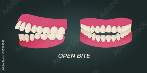 Medical dental diagram illustration. Orthodontist human tooth anatomy. Vector infographics with teeth diagrams.