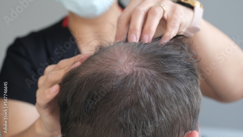 doctor check before hair transplant