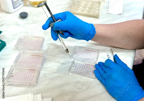 Digging out the reagent in Terasaki's chambers. Laboratory research. photo