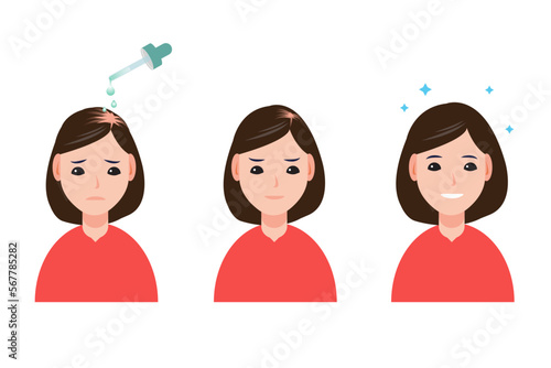 The woman treat hair loss vector isolated on white background.