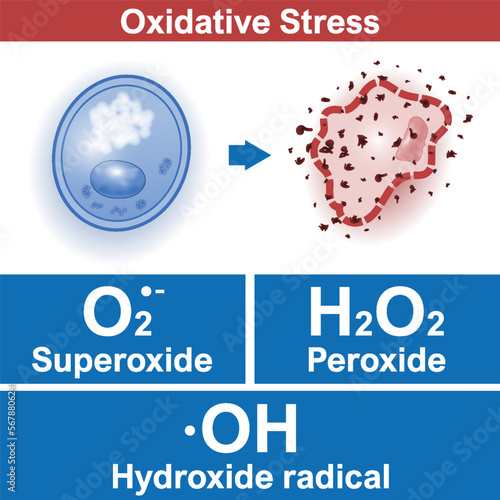 Oxidative stress factors, healthy cell is attacked by free radicals. Superoxide, Peroxide, Hydroxide radical. Medical vector illustration