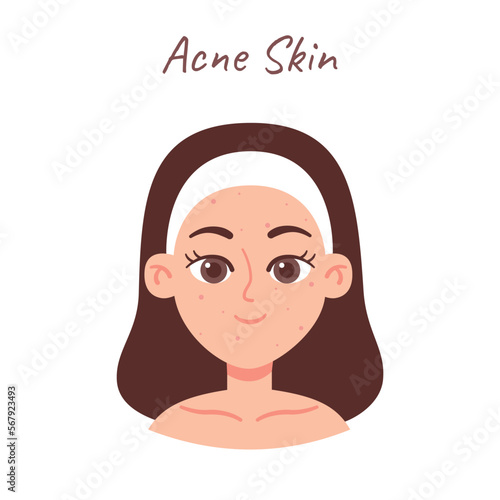 Skin Type illustration. Acne skin