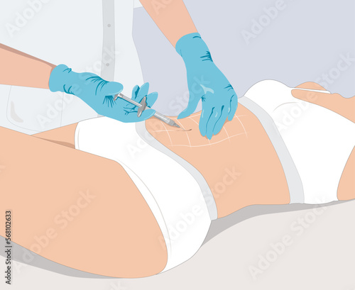 Illustration. Aesthetic cosmetologist makes lipolytic injections to burn fat on the legs and body of a woman. Female aesthetic cosmetology in a beauty salon.Cosmetology concep