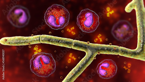 Splendore-Hoeppli phenomenon, 3D illustration. Eosinophilic reaction around the invading fungal hyphae in human tissues photo