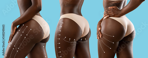 Young african american women in beige lingerie with perfect skin with lines for body shaping or drainage massage photo