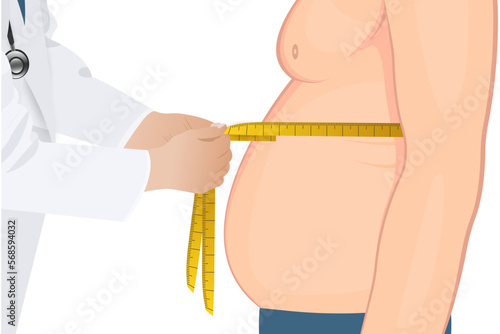 Doctor measuring obesity male body fat waist. Obesity and weight loss