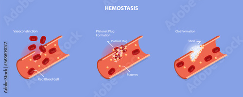 3D Isometric Flat Vector Conceptual Illustration of Hemostasis, Wound Healing Process Stages, Vasoconstriction and Clot Formation photo