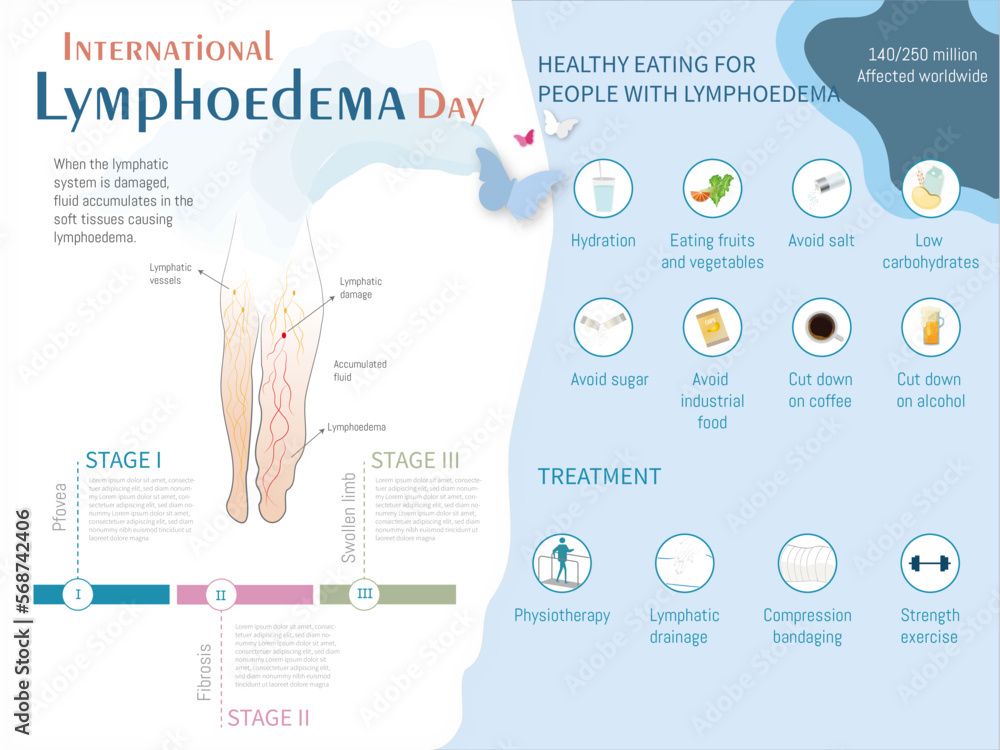 Poster Infographic Lymphedema, stage, treatments and recommended diet with corresponding icons ...