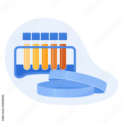 Urine colour chart. Hydration and dehydration level diagram. Medical urinal test kit for urinary tract infection research. Containers with yellow to brown pee for urinalysis. Vector illustration.
