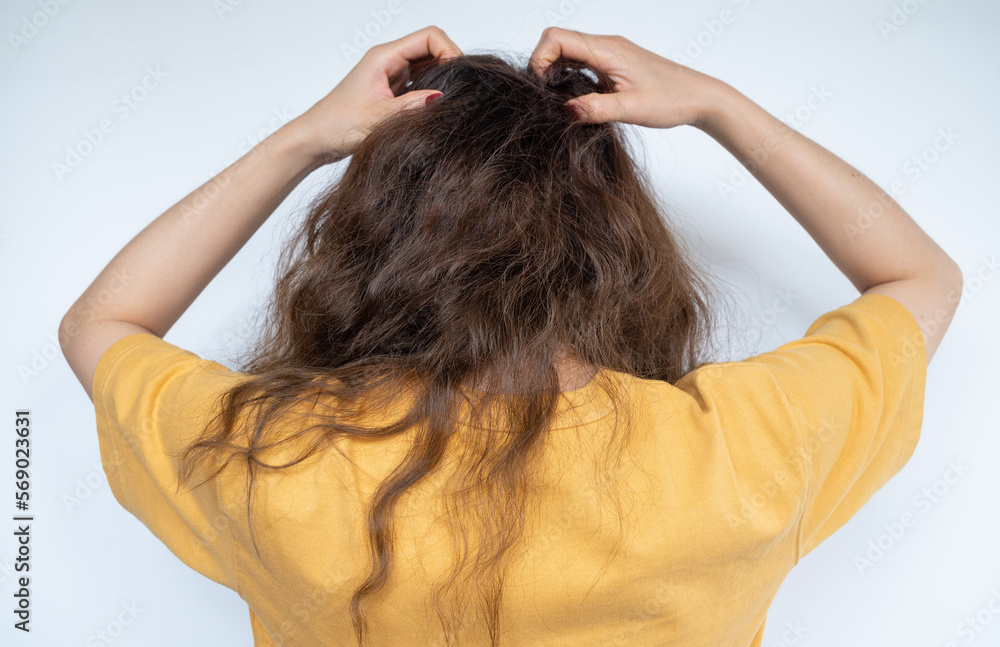 Fototapeta premium Rear view of young woman while scratching her scalp caused of itchy scalp.